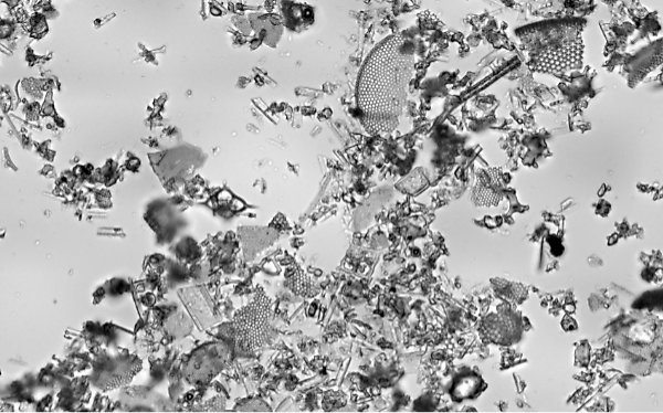Highly magnified view of diatomaceous earth under bright light